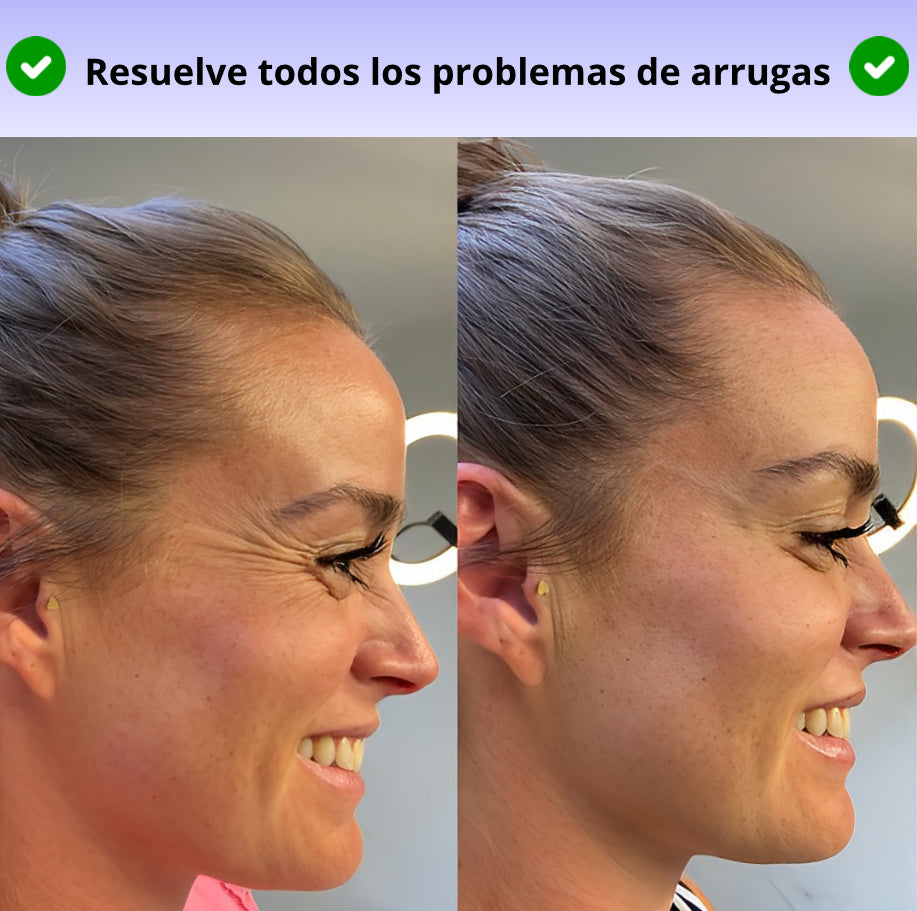 Vitalia® - BEE VENOM BOTOX Reduzca las arrugas inmediatamente Portugal