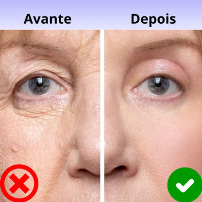 Vitalia® - BEE VENOM BOTOX Reduzca las arrugas inmediatamente Portugal